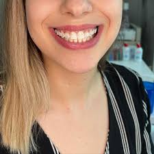 <em>Es la mejor compra que he hecho en años! funcional y practico            Pamela Henriquez - Compradora de Instagram</em>